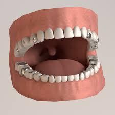 TMJ Treatment