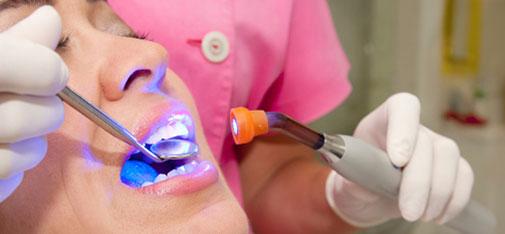 Laser Dentistry