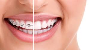 Orthodontics Melbourne