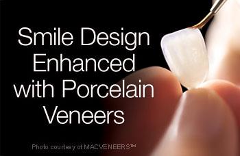 Porcelain Veneers Melbourne