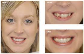 Orthodontist Melbourne