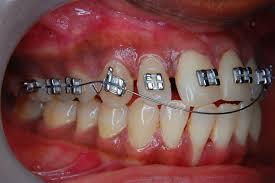 Orthodontics Melbourne