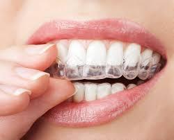 Invisalign Melbourne