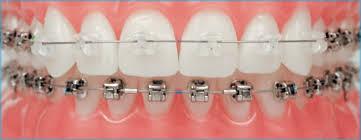 Orthodontics Melbourne