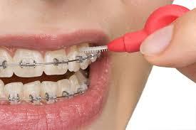 Orthodontist Melbourne