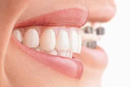 Orthodontist Melbourne