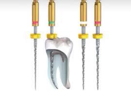 Root Canal Treatment