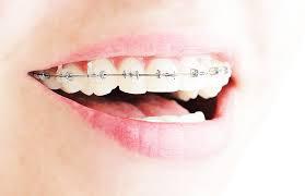 Orthodontist in Melbourne