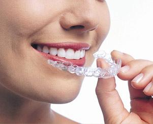 Orthodontics Melbourne