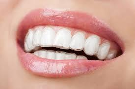 Invisalign Treatment