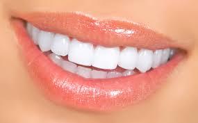 Porcelain Veneers