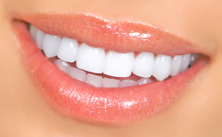 Porcelain Veneers Melbourne