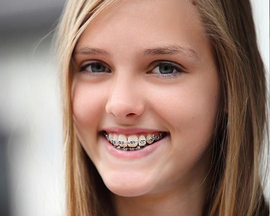 Orthodontics Melbourne